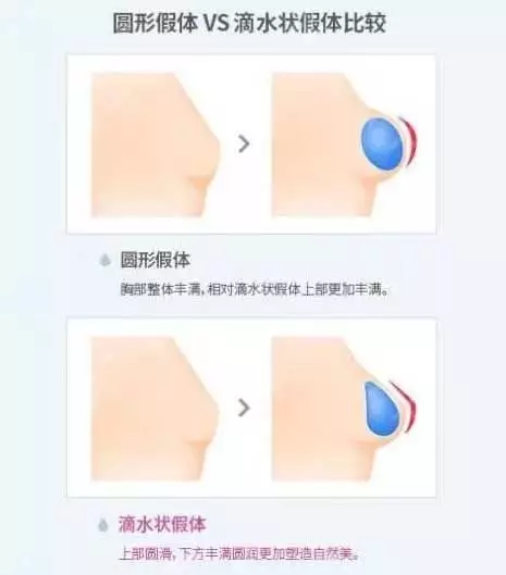 [我問大醫師]隆乳手術問題，你想要的答案，這里都有