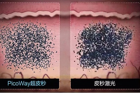 美萊實驗室：據統(tǒng)計90%的長斑都與夏天這一東西有關，你臉上的斑點是嗎？