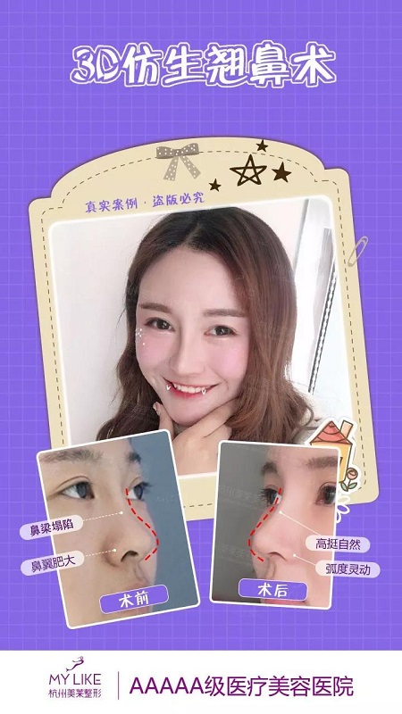 CURE全度美眸，仿生3D翹鼻，想美哪里你來定
