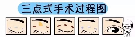美眼張誠坐診美萊，淺談為什么你的眼睛不夠美？
