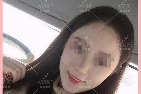 顏值日志 | 鼻子對整體顏值的改變有多大？