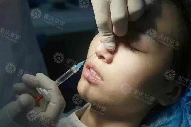 同樣是打玻尿酸，注意這幾點(diǎn)讓效果更持久
