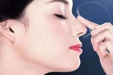 鼻翼縮小手術(shù)能維持時間 不留痕必看這幾點(diǎn)