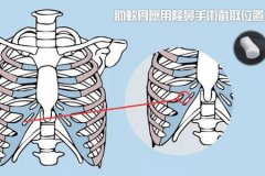 深圳隆鼻醫(yī)院做軟骨隆鼻多少錢(qián)，術(shù)后安全嗎