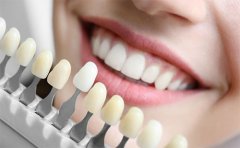 美白牙齒的價格是多少錢啊，廣州、深圳、天津價格一覽表